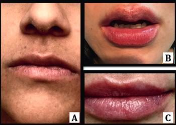 Revista