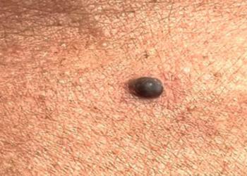 revista