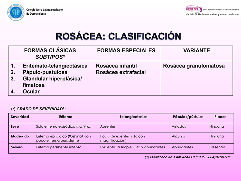 Criterios Diagnósticos En Dermatología Clasificación Y Grados De Severidad De La Rosácea 5681