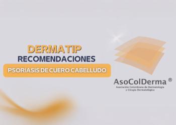 Psoariasis en cuero cabelludo