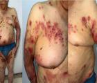 CASO #375