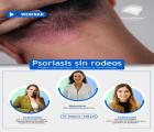 Psoriasis sin rodeos