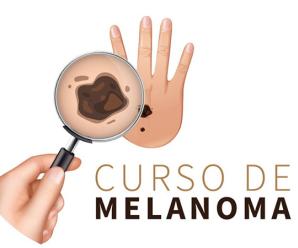 Curso Melanoma