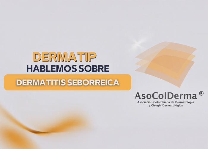 Dermatitis Seborreica