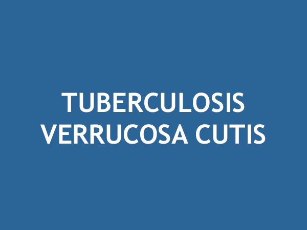 Tuberculosis verrucosa cutis | AsoColDerma